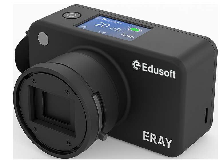 Digital Portable X-Ray